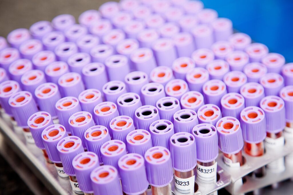 laboratory, samples, tubes, laboratory, laboratory, laboratory, laboratory, laboratory